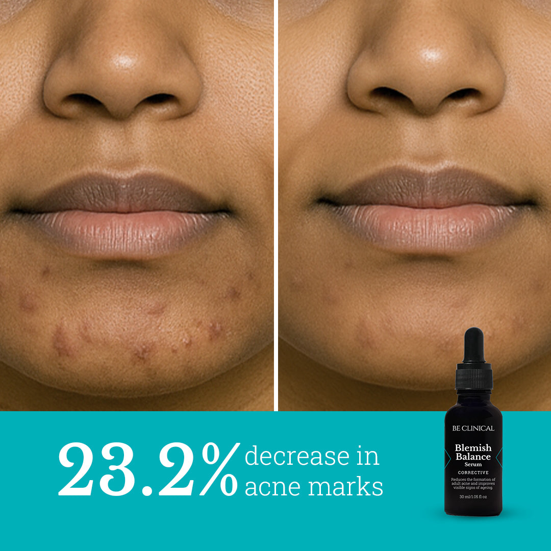 Blemish Balance and FirmX | Advanced corrective duo for clearer and firmer skin