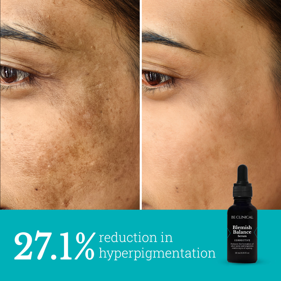 Blemish Balance and FirmX | Advanced corrective duo for clearer and firmer skin