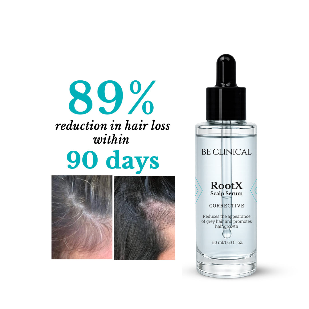 RootX Scalp Serum