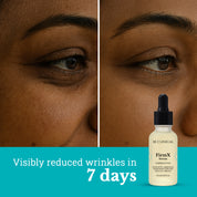 FirmX Serum with Niacinamide & Argireline | Anti Wrinkle Serum