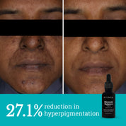 Neck Repair and Blemish Balance | Care for Menopausal Skin