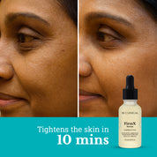 FirmX Serum with Niacinamide & Argireline | Anti Wrinkle Serum