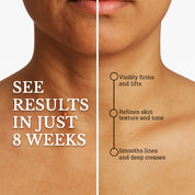 Neck Repair and Blemish Balance | Care for Menopausal Skin