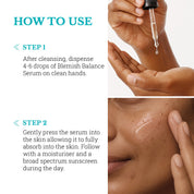 Blemish Balance Serum | Reduces Hyperpigmentation and Acne Marks