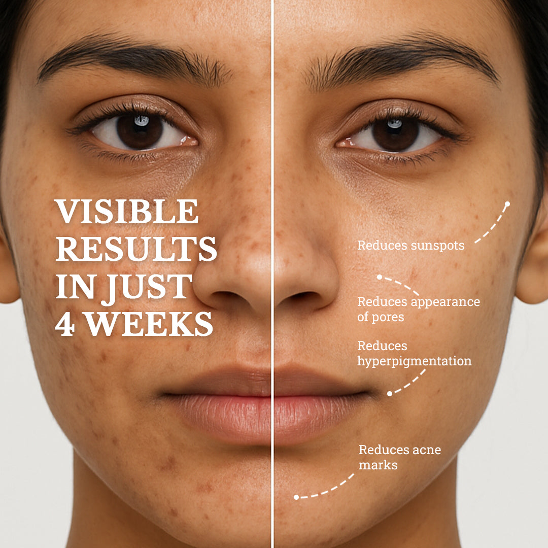 Neck Repair and Blemish Balance | Care for Menopausal Skin