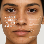 Neck Repair and Blemish Balance | Care for Menopausal Skin