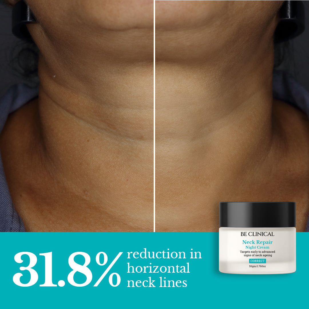 Before and after comparison of neck lines with a jar of BE CLINICAL Neck Repair Night Cream.