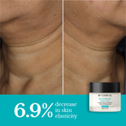 Neck Repair and Blemish Balance | Care for Menopausal Skin